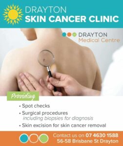 skin cancer ckeckups