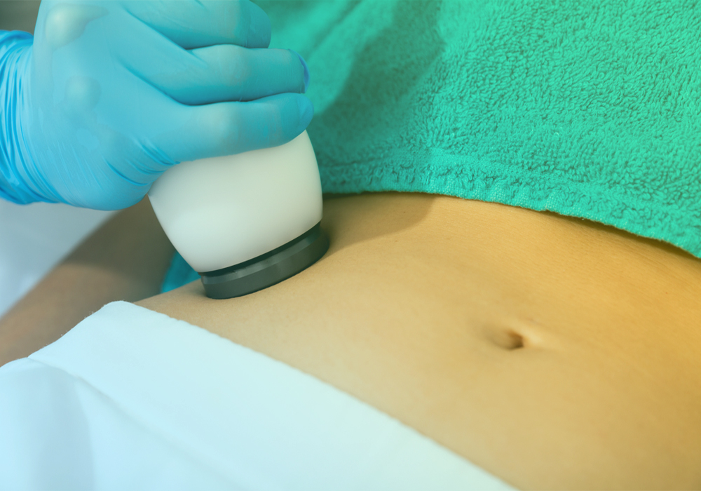 Top Benefits Of Availing Non-Surgical Body Sculpting Treatment